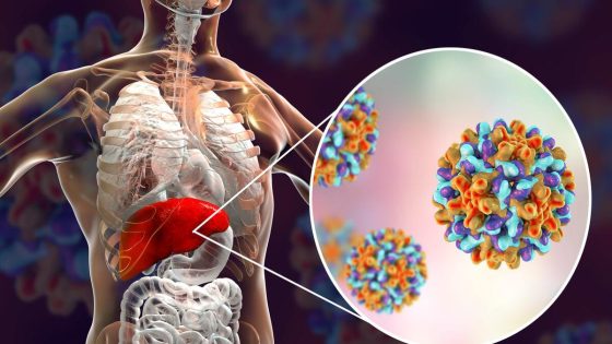 منظمة الصحة تعلن رسميا المغرب بلدا متحكما في التهاب الكبد الفيروسي “ب”